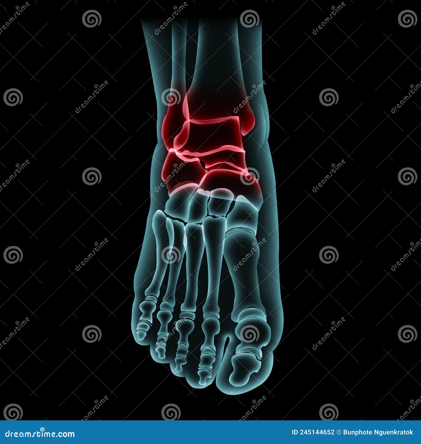 bone foot Ã¢â¬â¹ onÃ¢â¬â¹ blackÃ¢â¬â¹ background.x-ray film forÃ¢â¬â¹ checkÃ¢â¬â¹ ,diagnosis orÃ¢â¬â¹ analysis brokenÃ¢â¬â¹ boneÃ¢â¬â¹ pain for